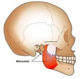 muscle masseter