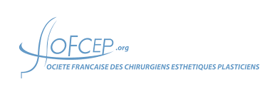 sofcep