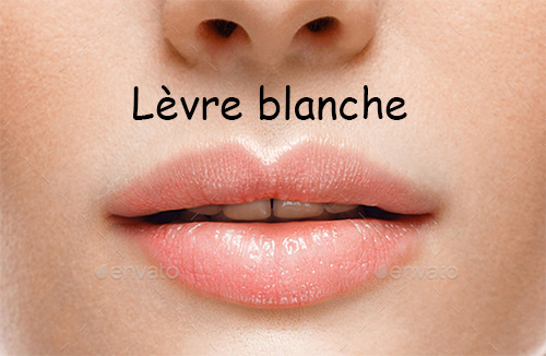 levre-blanche.jpg
